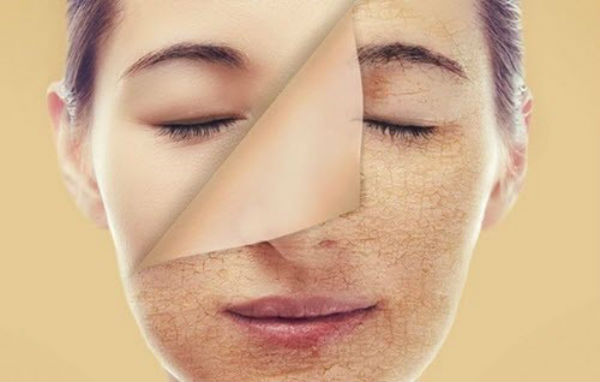 mặt nạ tẩy tế bào chết cho da nhờn